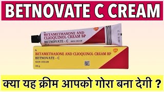 Betnovate C Cream Review | Betnovate C Cream benefits