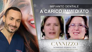 Cannizzo Studio - Impianto Dentale Fisso In Un Giorno