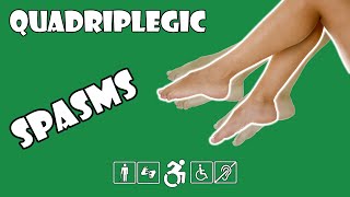 Muscle Spasms Explained | Quadriplegic (C5,C6,C7)