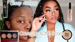 HOW TO COVER ACNE SCARS | Privemacho