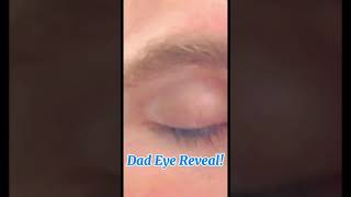 Dad Eye Reveal! ⚡️💙😎🤩🤗💙⚡️