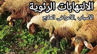 لو عاوز تعدي الشتا من غير التهاب رئوي .((لازم تسمع الفيديو ده))...