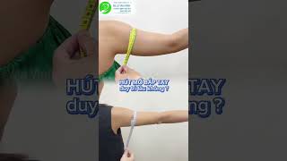 Hút Mỡ Bắp Tay Duy Trì Được Bao Lâu - Thẩm Mỹ Khang Vĩnh