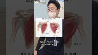 팔을 옆으로 들어올릴 때 통증이 발생하는 질환 '어깨충돌증후군'