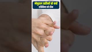 एक्जिमा में कौन सी क्रीम लगाएं | Which cream can be used for eczema | एक्जिमा क्रीम #shorts