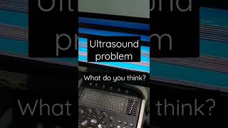 Ultrasound problem (2) - it's either the monitor or the IO of the ultrasound. what is your opinion?