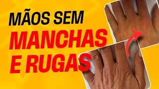 Fique com mãos maravilhosas sem MANCHAS e RUGAS | Melhor do que o creme que você usa