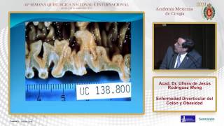 Enfermedad Diverticular del Colon y Obesidad, Acad. Dr. Ulises de Jesús Rodríguez Wong - 25/09/2014