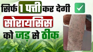 सोरायसिस का इलाज | नीम करेगा सोरायसिस का इलाज | Psoriasis Management: Neem Leaves, Diet Tips