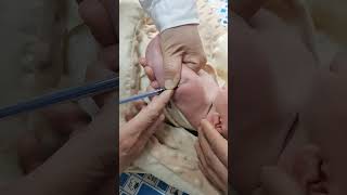 How To Give Injection To Newborn ? ||#newborn #injection #virolshort #medicaldevice #babycare