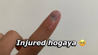 Injured hogaya | ball lag gai 🥺 | Cricket