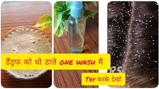 इस एक चीज़ से साफ़ करे Oily Dandruff सिर्फ 1 Wash में- Anti-Dandruff Shampoo, spray100%Result in 1 Use