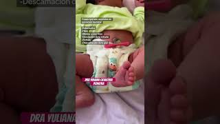 Sabías que estas cosas son normales en los recién nacidos? #bebe #reciénnacido  #pediatra