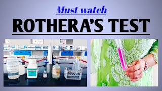 Rothera's test || Ketone bodies in urine || #Biochemistry