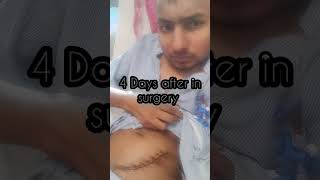 kidney transplant 4 Days after in surgery #kidneyvideo        kidney transplant surgery after Life