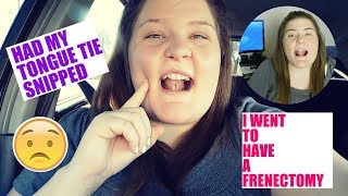 I WENT TO HAVE A FRENECTOMY | Had My Tongue Tie Snipped