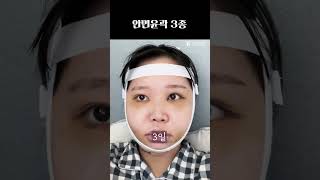 안면윤곽 3종으로 자신감 얻기 #Shorts