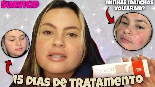 15 DIAS USANDO SUAVICID | FIM DO MELASMA | Ket Brinhol ✨