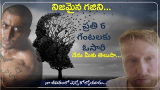 Real Life Ghajini Who Forgets For Every 6 Hours || Intersting Stories In Telugu || Telugu RSW.