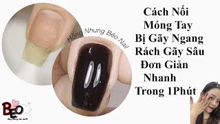 Cách Nối Tay Móng Bị Gãy Ngang Thịt Của Móng - Mẹo Làm Nail