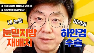 눈밑지방재배치 vs 하안검수술??🙄 어떤것을 해야 할지 알려드릴게요!😆 - 백승준