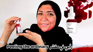 تجربتي مع مقشر ✨🍇the ORDINARY  Ma routine Skin care👩🏻‍🔬