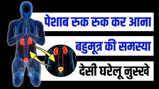 पेशाब रुक रुक कर आना या बहुमूत्र की समस्या |प्रोस्टेट में इन्फेक्शन | गदूद में सूजन कि घरेलू नुस्खे