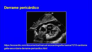 Dolor torácico anterior II Dr  Fata