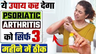 गठिया का इलाज क्या है | Psoriatic Arthritis को कैसे ठीक करें | सोरायसिस गठिया को ठीक करने का उपाय