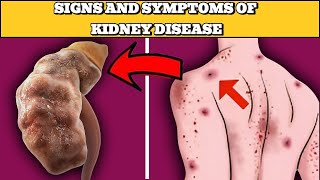 9 Early Signs Of Kidney Failure - Improve Kidney Health