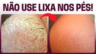 Como cuidar dos pés sem usar LIXA | Momento Beleza & Saúde