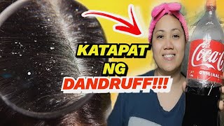 ANTI DANDRUFF HOME REMEDY SUPER EFFECTIVE ITO GRABE!!!