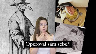 10 OPRAVDU DĚSIVÝCH FOTEK Z MEDICINSKÉ HISTORIE - OPEROVAL SE VÁŽNĚ SÁM? ALKOHOL MÍSTO ANESTEZIE?