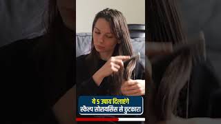 ✅ ये 5 उपाय दिलाएंगे स्कैल्प सोरायसिस से छुटकारा | Scalp Psoriasis Home Remedies #shorts #shortvideo