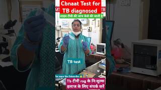 टीवी  रोग  की  जांच  कैसे  #TB #doctor  TB #TB Rog # lab technicians# TB test #TB desease ,#khashi