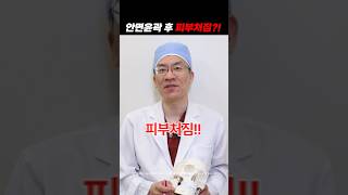 안면윤곽 후 피부처짐 #shorts #plasticsurgeryinkorea