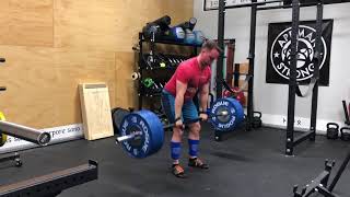 1/22/18 Deadlift 2ct Pause 315x3 @8 ws 2/4