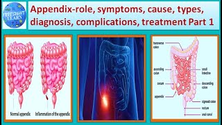 Appendix role, Symptoms, causes, types, Risk factor, diagnosis, treatment Part 1