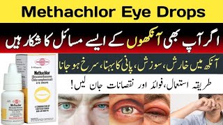 Methachlor eye drops uses in urdu | methachlor eye drops for baby | methachlor eye drops |