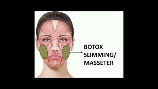 BOTOX