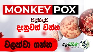 Monkey Pox පිලිබදව දැනුවත් වන්න, වලක්වා ගන්න | Be aware of Monkey pox and prevent it Anushika Perera