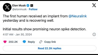 Neuralink's MIND-BLOWING Breakthrough! First Human Brain Chip Implant REVEALED by Elon Musk!