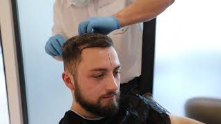 Alex and Daniel's Hair Transplant Journey in Turkey I Clinic International