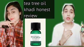 How to use TEA TREE OIL For pimple ,Belemishes// honest review