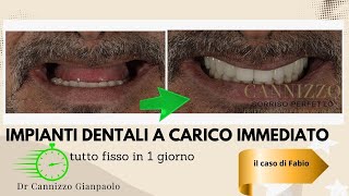 Un caso di implantologia dentale sull'intera arcata - Studio Dentistico Cannizzo