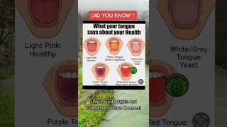 Toungue Health #health #healthy #healthfacts #healthrisks #tongue #healthtips #shorts