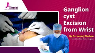 Ganglion Cyst Excision from Wrist Surgery | Expert Procedure by Dr. Neeraj Bhaban