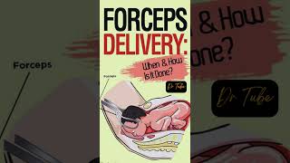 forceps delivery when & how is it done | संदंश वितरण दुष्प्रभाव #pregnancy #baby #force