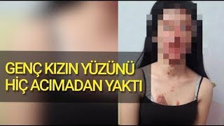 NİŞANLISI YÜZÜNÜ YAKTI KAÇTI ''BERFİN ÖZEK''