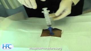 Bone Marrow Biopsy Video